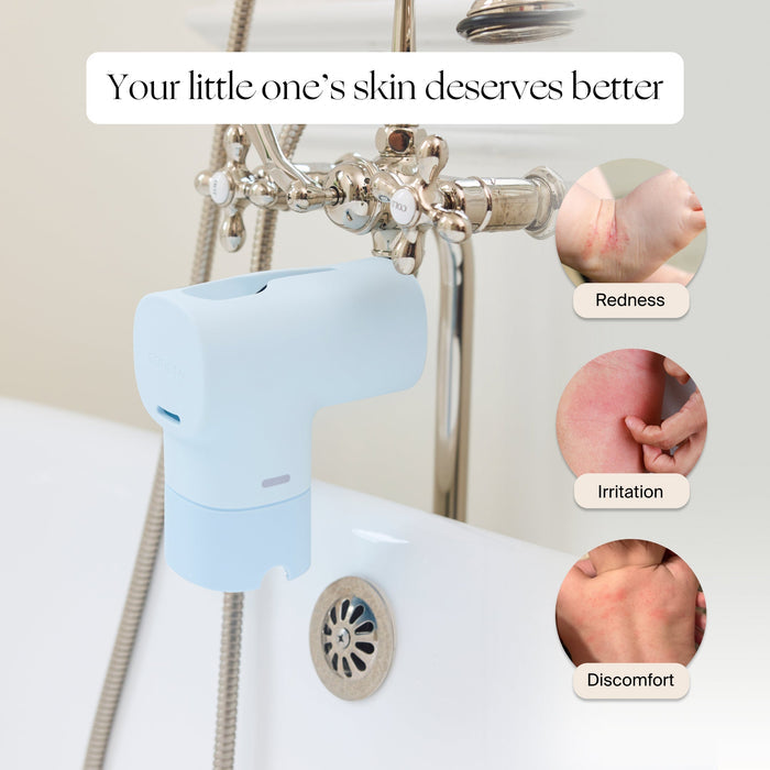 A light blue baby skin protection cap shown attached to a shower hose and faucet, with text reading 'Your little one's skin deserves better' and three circular inset photos showing skin irritation labeled Redness, Irritation, and Discomfort.