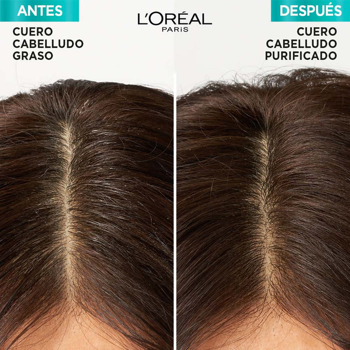 Shampoo Elvive Hialurónico Pure - Raíz Grasa Puntas Deshidratadas X 680Ml